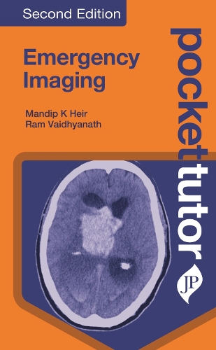 Paper book «Pocket Tutor Emergency Imaging», authors Mandip K. Heir, Ram Vaidhyanath - фото №1