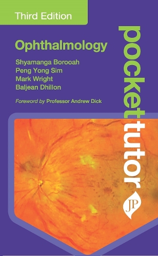 Паперова книга «Pocket Tutor Ophthalmology», авторів Бал Діллон, Марк Райт, Пенг Йонг Сім, Шьяманга Боруа - фото №1