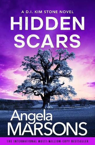 Паперова книга «Hidden Scars: A completely gripping crime thriller with a nail-biting twist», автор Анжела Марсонс - фото №1