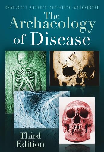 Бумажная книга «The Archaeology of Disease: Fourth Edition», авторов Шарлотта Робертс, Джакалин Даффин, Кит Манчестер, Мэри Льюис - фото №1