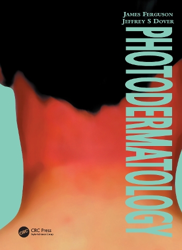 Паперова книга «Photodermatology», авторів Джеймс Фергюсон, Джеффрі Дувер - фото №1