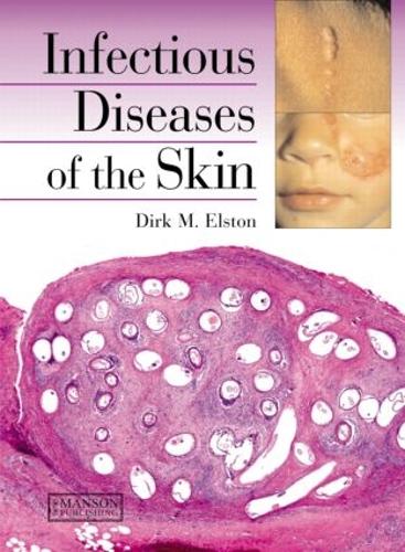 Паперова книга «Infectious Diseases of the Skin», автор Дірк Елстон - фото №1