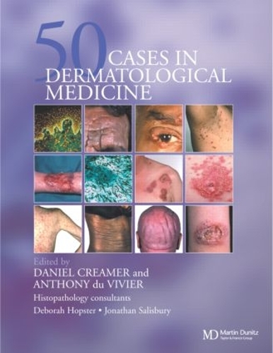 Паперова книга «Fifty Dermatological Cases», авторів Ентоні дю Вів'є, Деніел Крімер - фото №1