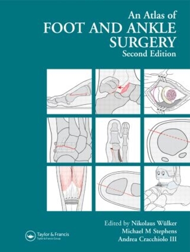 Паперова книга «Atlas Foot and Ankle Surgery» - фото №1