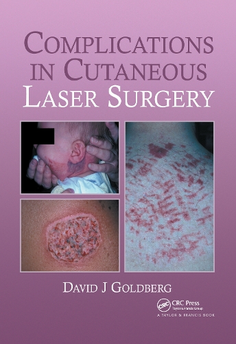 Бумажная книга «Complications in Laser Cutaneous Surgery», автор Дэвид Дж. Голдберг - фото №1