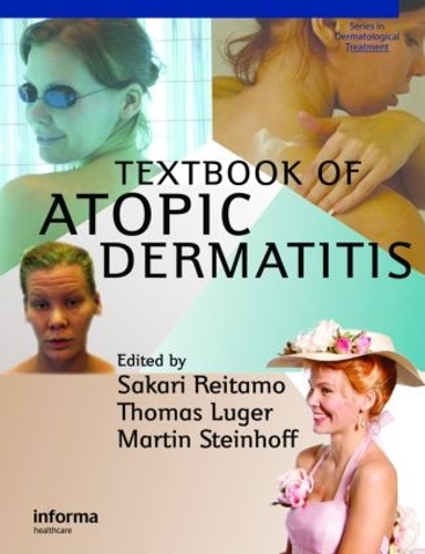 Бумажная книга «Textbook of Atopic Dermatitis», авторов Мартин Штайнхофф, Сакари Рейтамо, Томас А. Люгер - фото №1