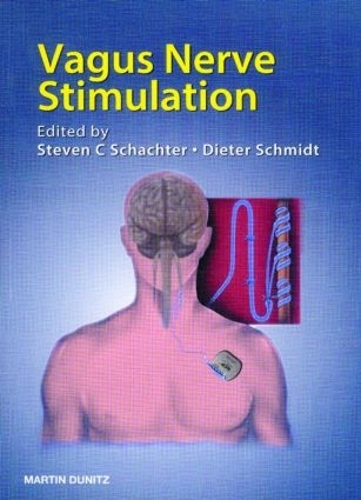 Паперова книга «Vagus Nerve Stimulation» - фото №1