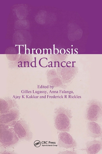 Паперова книга «Thrombosis and Cancer» - фото №1