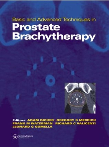 Паперова книга «Basic and Advanced Techniques in Prostate Brachytherapy» - фото №1