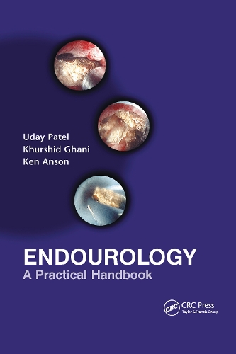 Бумажная книга «Endourology: A Practical Handbook» - фото №1