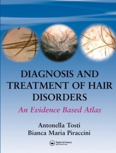 Паперова книга «Diagnosis and Treatment of Hair Disorders: An Evidence-Based Atlas», авторів Антонелла Тості, Бьянка Марія Пірачіні - фото №1