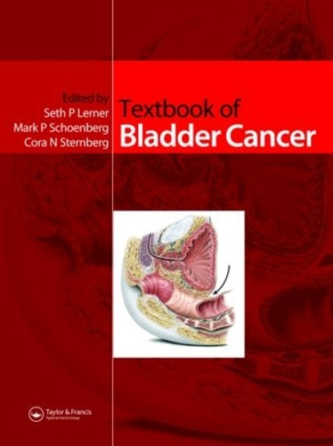 Паперова книга «Textbook of Bladder Cancer» - фото №1