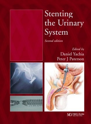 Бумажная книга «Stenting the Urinary System», авторов Дэниел Ячия, Питер Дж. Патерсон - фото №1