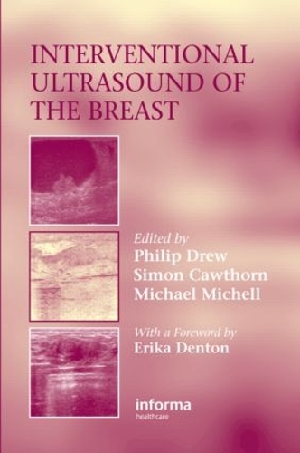 Паперова книга «Interventional Ultrasound of the Breast» - фото №1