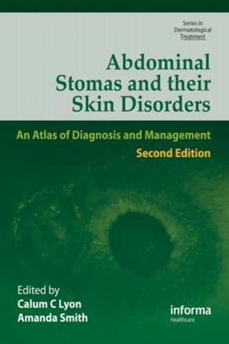 Бумажная книга «Abdominal Stomas and Their Skin Disorders» - фото №1