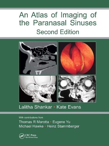 Паперова книга «Atlas of Imaging of the Paranasal Sinuses, Second Edition» - фото №1