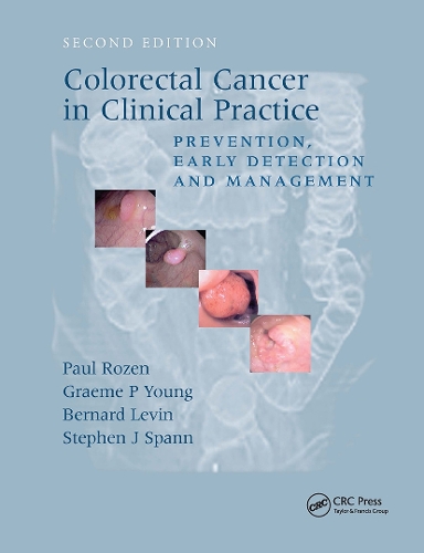 Паперова книга «Colorectal Cancer in Clinical Practice: Prevention, Early Detection and Management, Second Edition» - фото №1