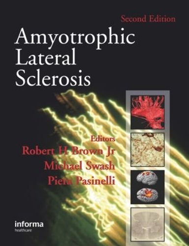 Паперова книга «Amyotrophic Lateral Sclerosis, Second Edition» - фото №1