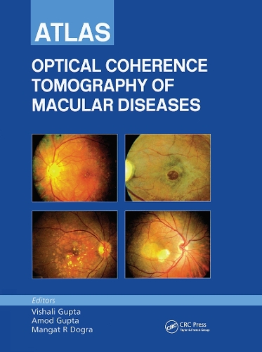 Бумажная книга «Atlas of Optical Coherence Tomography of Macular Diseases», авторов Амод Гупта, Мангат Р. Догра, Вишали Гупта - фото №1