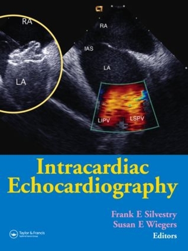 Бумажная книга «Intracardiac Echocardiography», авторов Фрэнк Э. Сильвестри, Сьюзан Э. Вигерс - фото №1
