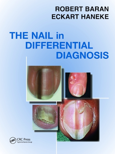 Бумажная книга «Nail in Differential Diagnosis», авторов Экарт Ханеке, Роберт Баран - фото №1