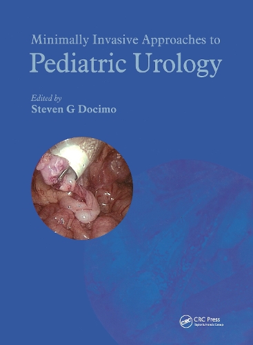 Паперова книга «Minimally Invasive Approaches to Pediatric Urology» - фото №1