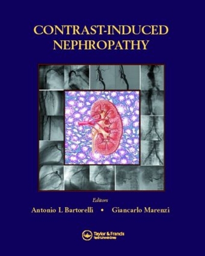 Паперова книга «Contrast-Induced Nephropathy in Interventional Cardiovascular Medicine» - фото №1