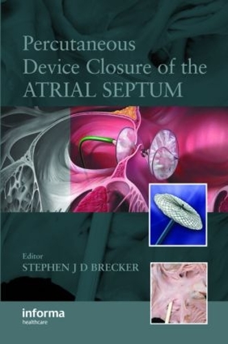 Бумажная книга «Percutaneous Device Closure of the Atrial Septum» - фото №1