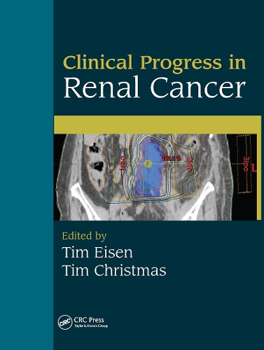 Бумажная книга «Clinical Progress in Renal Cancer» - фото №1