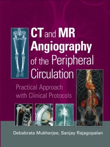 Бумажная книга «CT and MR Angiography of the Peripheral Circulation: Practical Approach with Clinical Protocols» - фото №1