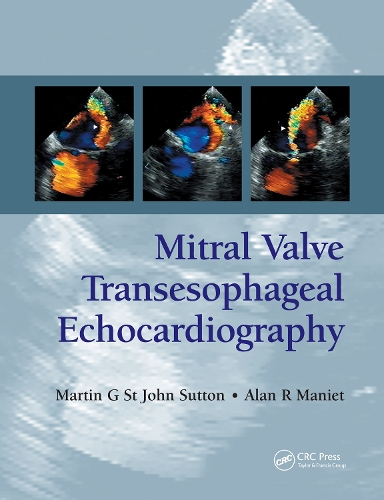 Бумажная книга «Mitral Valve Transesophageal Echocardiography», авторов Алан Р. Маниет, Мартин Г. Сент-Джон Саттон - фото №1