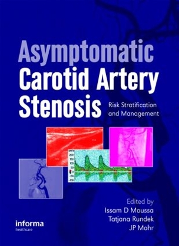 Паперова книга «Asymptomatic Carotid Artery Stenosis: A Primer on Risk Stratification and Management» - фото №1