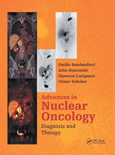 Паперова книга «Advances in Nuclear Oncology:: Diagnosis and Therapy» - фото №1