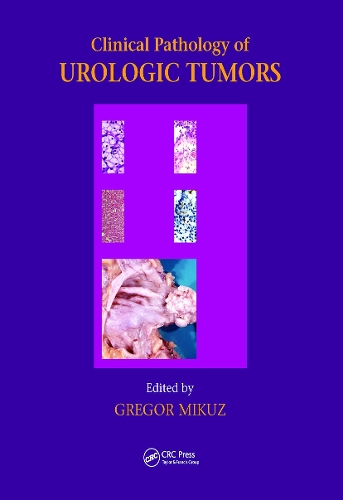Паперова книга «Clinical Pathology of Urological Tumours» - фото №1