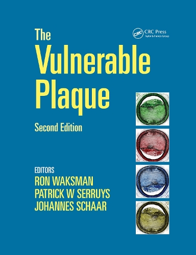 Паперова книга «Handbook of the Vulnerable Plaque» - фото №1
