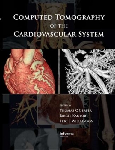 Паперова книга «Computed Tomography of the Cardiovascular System» - фото №1