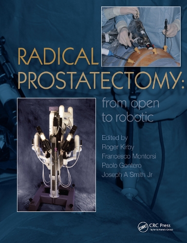 Паперова книга «Radical Prostatectomy: From Open to Robotic» - фото №1