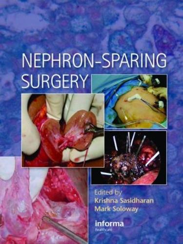 Паперова книга «Nephron-Sparing Surgery» - фото №1