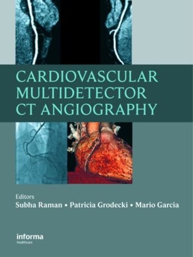 Бумажная книга «Cardiovascular Multidetector CT Angiography», авторов Марио Гарсия, Патриция Гродецки, Субха Раман - фото №1