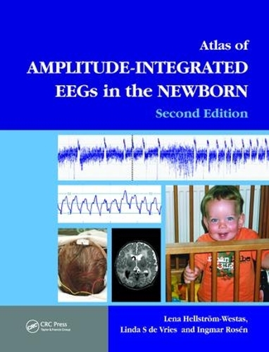Паперова книга «An Atlas of Amplitude-Integrated EEGs in the Newborn» - фото №1