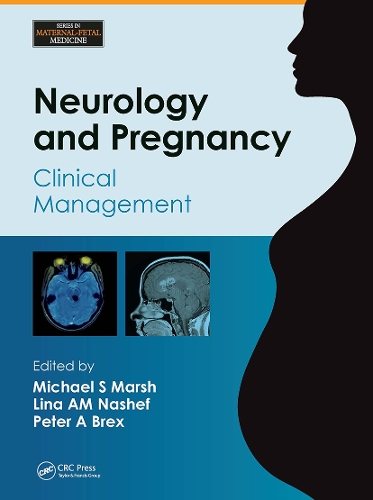Бумажная книга «Neurology and Pregnancy: Clinical Management» - фото №1