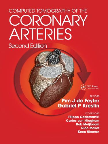 Бумажная книга «Computed Tomography of the Coronary Arteries» - фото №1