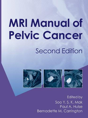 Паперова книга «MRI Manual of Pelvic Cancer,Second Edition» - фото №1