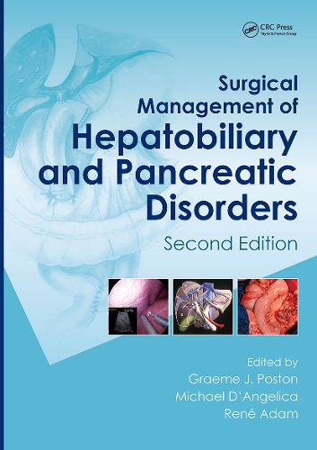 Паперова книга «Surgical Management of Hepatobiliary and Pancreatic Disorders, Second Edition» - фото №1