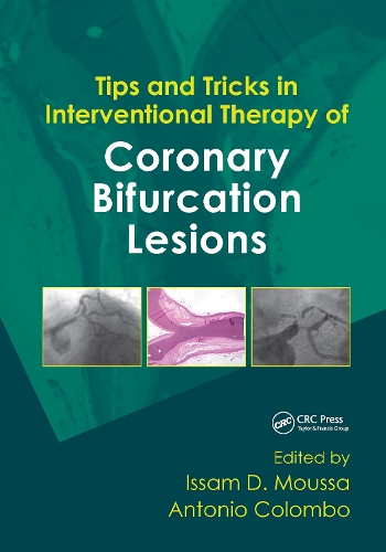 Бумажная книга «Tips and Tricks in Interventional Therapy of Coronary Bifurcation Lesions» - фото №1