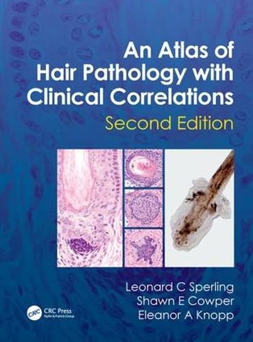 Бумажная книга «An Atlas of Hair Pathology with Clinical Correlations», авторов Элеонора А. Кнопп, Леонард С. Сперлинг, Шон Э. Каупер - фото №1