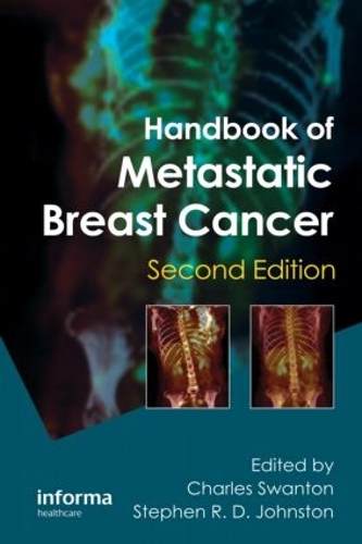 Паперова книга «Handbook of Metastatic Breast Cancer» - фото №1