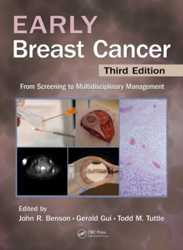 Паперова книга «Early Breast Cancer: From Screening to Multidisciplinary Management, Third Edition» - фото №1