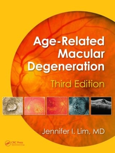 Паперова книга «Age-Related Macular Degeneration» - фото №1