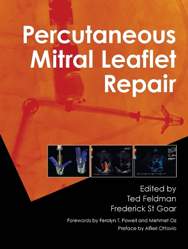 Бумажная книга «Percutaneous Mitral Leaflet Repair: MitraClip Therapy for Mitral Regurgitation» - фото №1